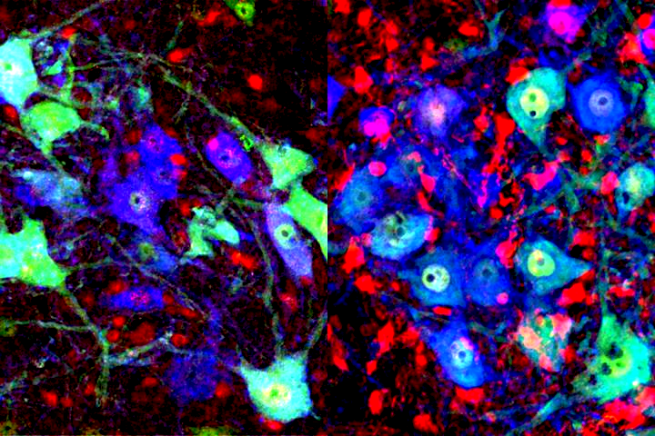 Regenerating nerves